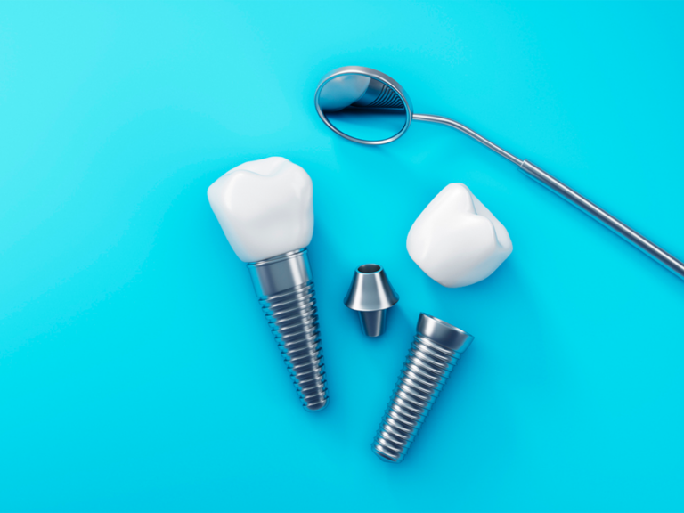 The image shows dental implants with ceramic crowns and a dental mirror on a blue background. The components of dental implants are illustrated, including the metal screws and ceramic crowns.